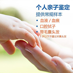 德阳匿名亲子鉴定去哪里做，德阳匿名亲子鉴定准确吗