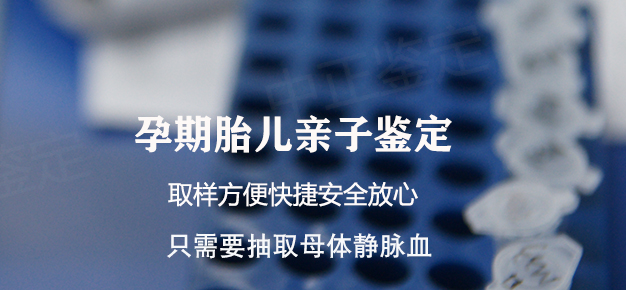 怀孕期间德阳要如何办理怀孕亲子鉴定,德阳办理孕期亲子鉴定结果准吗 怀孕期间德阳要如何办理怀孕亲子鉴定,德阳办理孕期亲子鉴定结果准吗